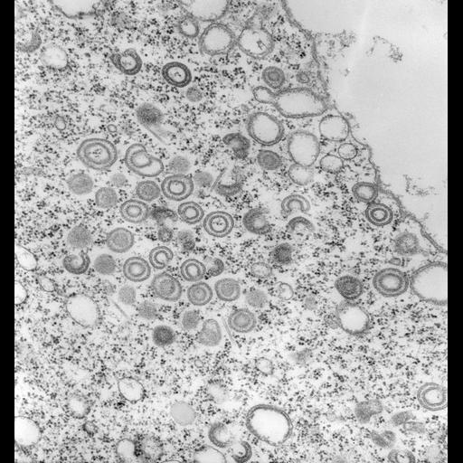  NCBI Organism:Vorticella convallaria; Cell Types:cell by organism, eukaryotic cell, , ; Cell Components:Golgi transport complex, food vacuole; Biological process:post-Golgi vesicle-mediated transport, Golgi to vacuole transport;