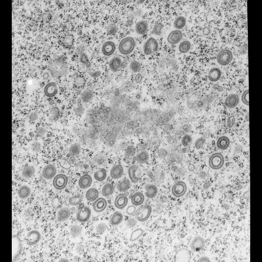  NCBI Organism:Vorticella convallaria; Cell Types:cell by organism, eukaryotic cell, , ; Cell Components:Golgi-associated vesicle membrane, food vacuole; Biological process:Golgi to vacuole transport