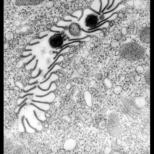  NCBI Organism:Vorticella convallaria; Cell Types:cell by organism, eukaryotic cell, , ; Cell Components:oral apparatus, microtubule associated complex, plasma membrane; Biological process:oral apparatus organization