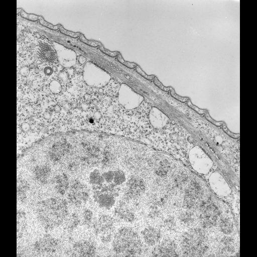  NCBI Organism:Vorticella convallaria; Cell Types:cell by organism, eukaryotic cell, , ; Cell Components:cell cortex, macronucleus, endoplasmic reticulum, ; Biological process:cortical cytoskeleton organization, macronucleus organization, endoplasmic reticulum organization, digestive system process;