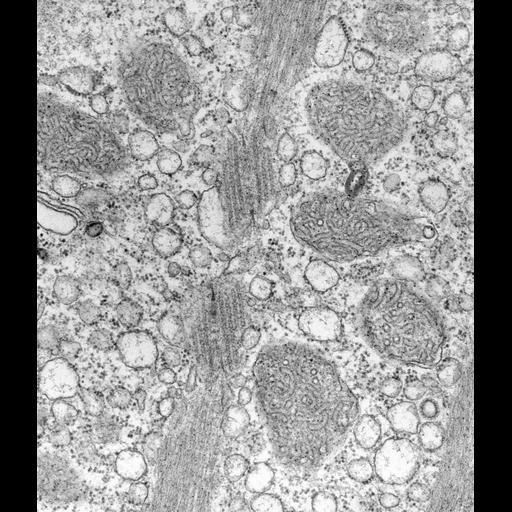  NCBI Organism:Vorticella convallaria; Cell Types:cell by organism, eukaryotic cell, , ; Cell Components:cytoplasm, endoplasmic reticulum, mitochondrion, mitochondrial inner membrane; Biological process:endoplasmic reticulum organization, mitochondrion organization;