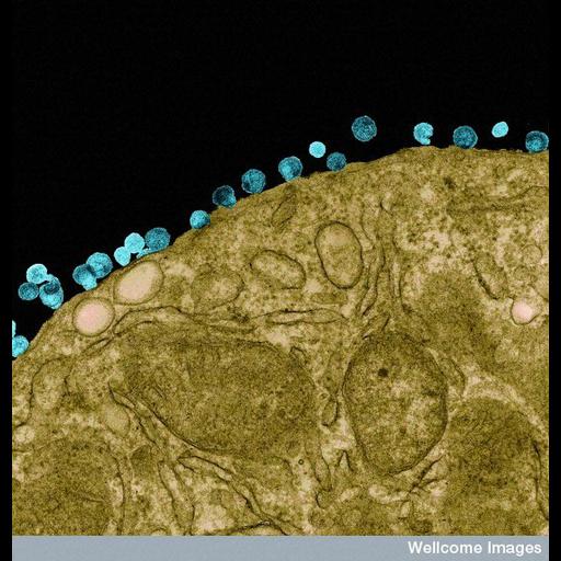  Cell Types:lymphocyte, ;