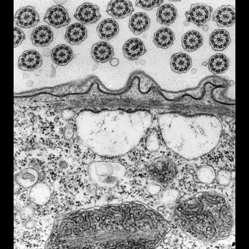  NCBI Organism:Vorticella convallaria; Cell Types:cell by organism, eukaryotic cell, , ; Cell Components:pellicle, endoplasmic reticulum, cell cortex, cilium; Biological process:cortical cytoskeleton organization, endoplasmic reticulum organization, cilium movement;