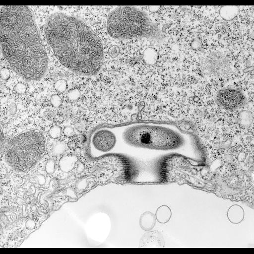  NCBI Organism:Vorticella convallaria; Cell Types:cell by organism, eukaryotic cell, , ; Cell Components:contractile vacuole, plasma membrane, contractile vacuolar membrane, contractile vacuole pore, microtubule associated complex, symbiont-containing vacuolar space; Biological process:contractile vacuole organization, plasma membrane organization, microtubule-based process, detection of symbiont;