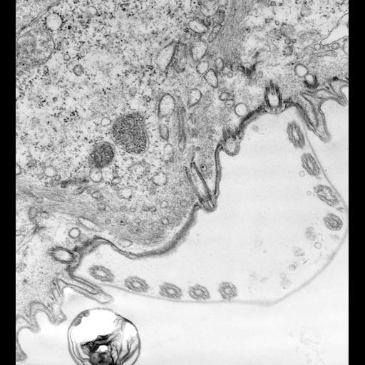  NCBI Organism:Vorticella convallaria; Cell Types:cell by organism, eukaryotic cell, , ; Cell Components:microtubule basal body, ; Biological process:microtubule basal body organization, ;