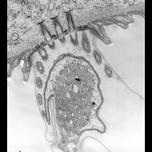  NCBI Organism:Vorticella convallaria; Cell Types:cell by organism, eukaryotic cell, , ; Cell Components:microfibril, plasma membrane, endoplasmic reticulum, ; Biological process:calcium ion transport, ;