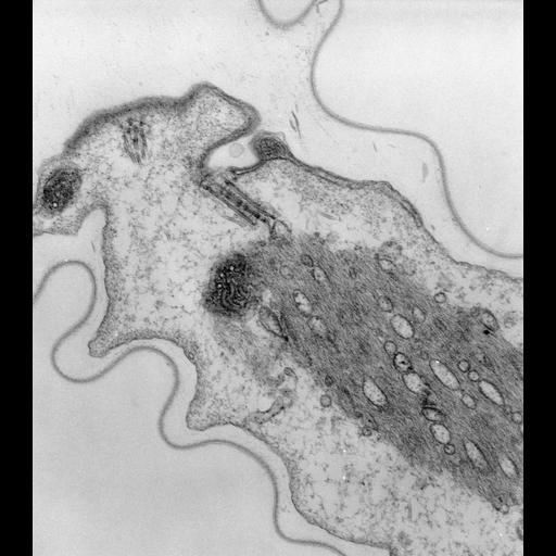  NCBI Organism:Vorticella convallaria; Cell Types:cell by organism, eukaryotic cell, , ; Cell Components:microtubule basal body, myofibril, ; Biological process:microtubule basal body organization, regulation of muscle contraction;