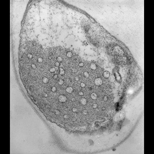  NCBI Organism:Vorticella convallaria; Cell Types:cell by organism, eukaryotic cell, , ; Cell Components:endoplasmic reticulum, myofibril, ; Biological process:, muscle system process;