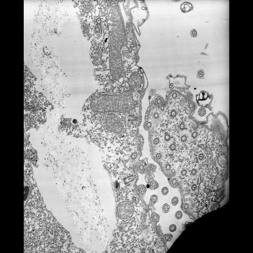  NCBI Organism:Tetrahymena pyriformis; Cell Types:cell by organism, eukaryotic cell, , ; Cell Components:oral apparatus, microtubule basal body, cell division site; Biological process:oral apparatus organization, , asymmetric cell division;