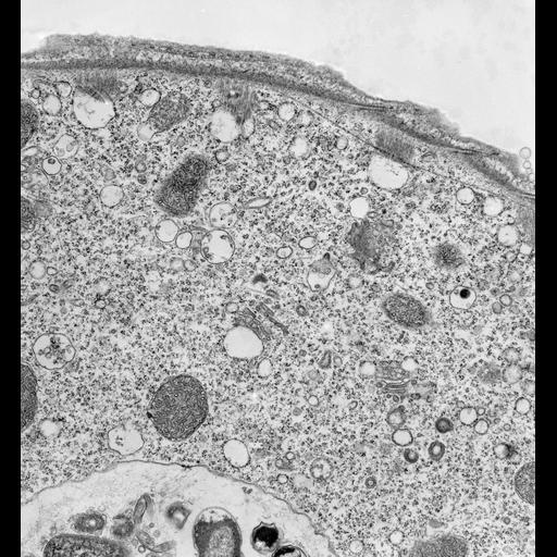  NCBI Organism:Vorticella convallaria; Cell Types:cell by organism, eukaryotic cell, , ; Cell Components:pellicle, rough endoplasmic reticulum, fibril; Biological process:cortical cytoskeleton organization, endoplasmic reticulum organization;