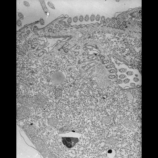  NCBI Organism:Tetrahymena pyriformis; Cell Types:cell by organism, eukaryotic cell, , ; Cell Components:microtubule basal body, oral apparatus; Biological process:oral apparatus organization, regulation of asymmetric cell division, microtubule basal body duplication;