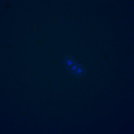  NCBI Organism:Saccharomyces cerevisiae; Cell Components:, nucleus, RENT complex, nucleolus; Biological process:chromatin silencing at rDNA, nucleolus organization, regulation of exit from mitosis, cell cycle, cell division, mitosis;