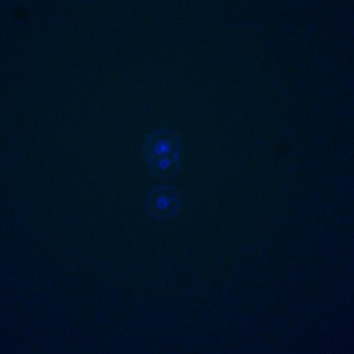  NCBI Organism:Saccharomyces cerevisiae; Cell Components:, nucleus, RENT complex, nucleolus; Biological process:chromatin silencing at rDNA, nucleolus organization, regulation of exit from mitosis, cell cycle, cell division, mitosis;