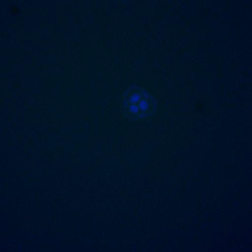  NCBI Organism:Saccharomyces cerevisiae; Cell Components:, nucleus, RENT complex, nucleolus; Biological process:chromatin silencing at rDNA, nucleolus organization, regulation of exit from mitosis, cell cycle, cell division, mitosis;