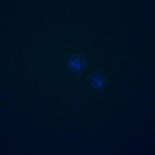  NCBI Organism:Saccharomyces cerevisiae; Cell Components:, nucleus, RENT complex, nucleolus; Biological process:chromatin silencing at rDNA, nucleolus organization, regulation of exit from mitosis, cell cycle, cell division, mitosis;