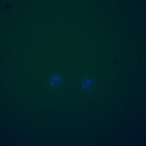  NCBI Organism:Saccharomyces cerevisiae; Cell Components:, cellular bud neck, spindle pole body; Biological process:cytokinesis, regulation of exit from mitosis, protein phosphorylation, meiotic anaphase II;