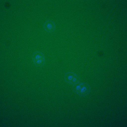  NCBI Organism:Saccharomyces cerevisiae; Cell Components:, cellular bud neck, spindle pole body; Biological process:cytokinesis, regulation of exit from mitosis, protein phosphorylation, meiotic anaphase II;