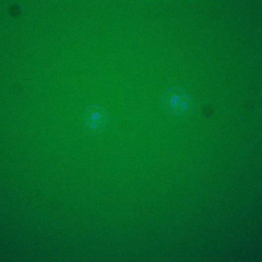  NCBI Organism:Saccharomyces cerevisiae; Cell Components:, cellular bud neck, spindle pole body; Biological process:cytokinesis, regulation of exit from mitosis, protein phosphorylation, meiotic anaphase II;