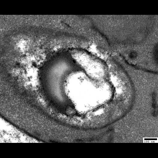  NCBI Organism:Saccharomyces cerevisiae; Cell Components:autophagic vacuole, autophagic vacuole membrane, lipid particle, vesicle; Biological process:vacuole organization, ;