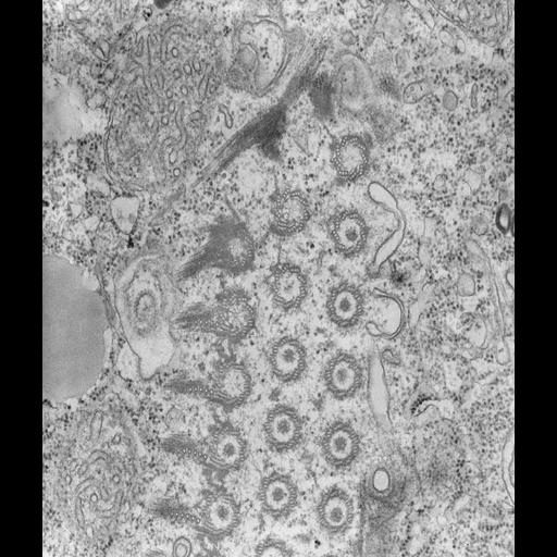  NCBI Organism:Tetrahymena pyriformis; Cell Types:cell by organism, eukaryotic cell, , ; Cell Components:oral apparatus Biological process:oral apparatus organization