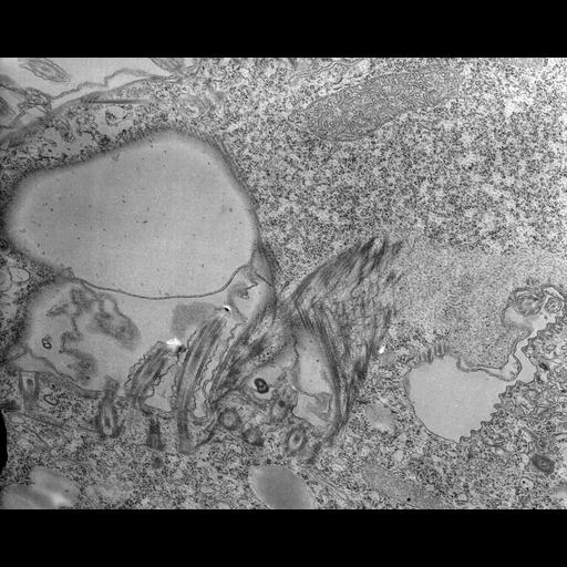  NCBI Organism:Tetrahymena pyriformis; Cell Types:cell by organism, eukaryotic cell, , ; Cell Components:oral apparatus Biological process:oral apparatus organization