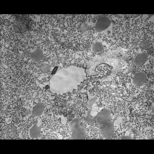  NCBI Organism:Tetrahymena pyriformis; Cell Types:cell by organism, eukaryotic cell, , ; Cell Components:oral apparatus, primary lysosome, , microtubule associated complex, ; Biological process:oral apparatus organization