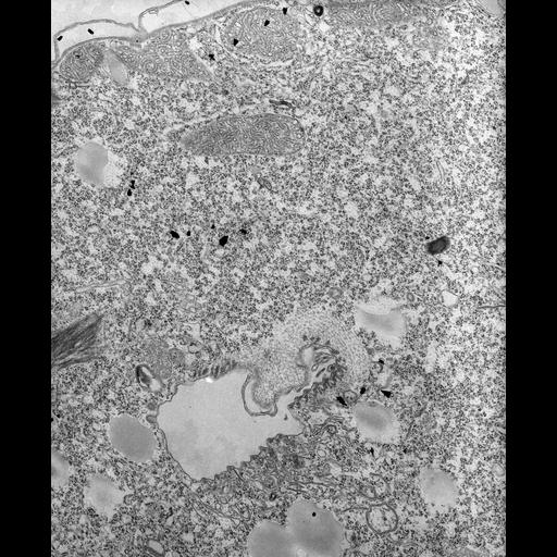  NCBI Organism:Tetrahymena pyriformis; Cell Types:cell by organism, eukaryotic cell, , ; Cell Components:, plasma membrane, microtubule associated complex, vesicle membrane; Biological process:oral apparatus organization