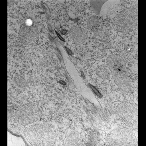  NCBI Organism:Tetrahymena pyriformis; Cell Types:cell by organism, eukaryotic cell, , ; Cell Components:cytostome, , ; Biological process:digestive system process