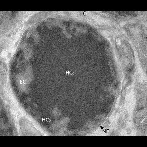  NCBI Organism:Mus musculus; Cell Types:retinal rod cell Cell Components:nucleus, chromatin, heterochromatin; Biological process:, chromatin organization, DNA packaging;