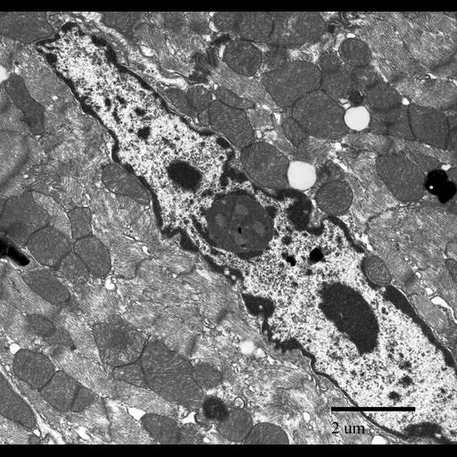  NCBI Organism:Mus musculus; Cell Types:cardiac muscle cell Cell Components:nucleus, nucleolus, nucleolus organizer region; Biological process:nucleolus organization