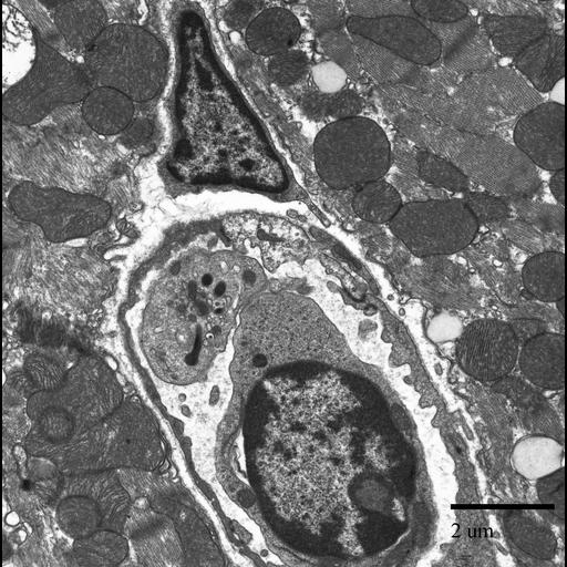  NCBI Organism:Mus musculus; Cell Types:blood cell, cardiac muscle cell, blood vessel endothelial cell; Cell Components:nucleus