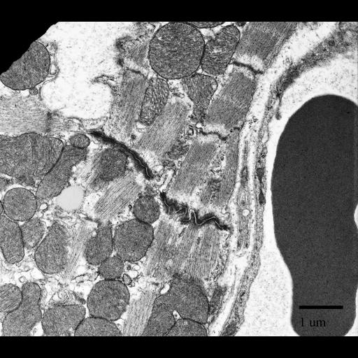  NCBI Organism:Mus musculus; Cell Types:cardiac muscle cell Cell Components:intercalated disc, gap junction, desmosome; Biological process:regulation of muscle contraction