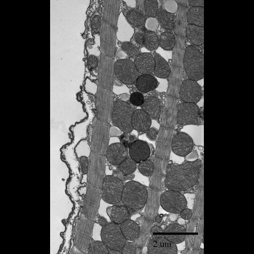  NCBI Organism:Mus musculus; Cell Types:cardiac muscle cell Cell Components:sarcoplasmic reticulum, mitochondrion, lipid particle; Biological process:atrial cardiac muscle tissue morphogenesis