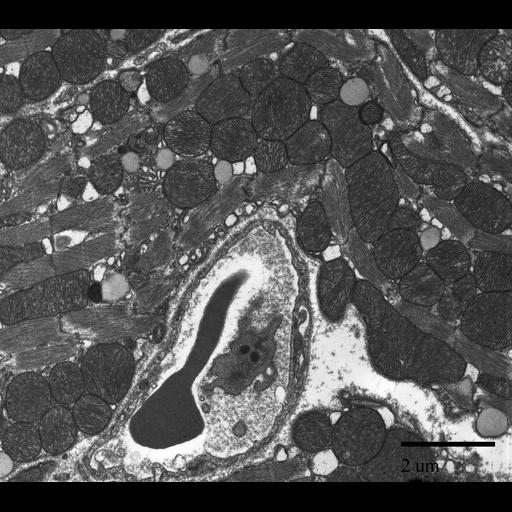  NCBI Organism:Mus musculus; Cell Types:cardiac muscle cell, blood cell; Cell Components:mitochondrion Biological process:atrial cardiac muscle tissue morphogenesis