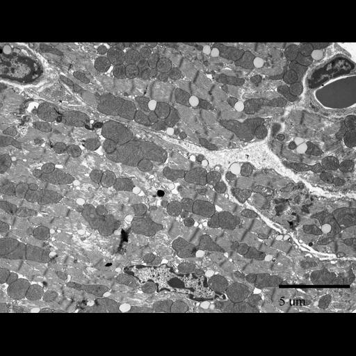  NCBI Organism:Mus musculus; Cell Types:cardiac muscle cell Cell Components:mitochondrion, nucleus, contractile fiber;