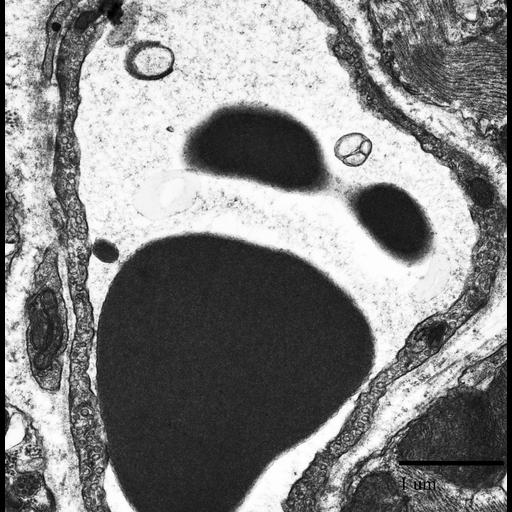  NCBI Organism:Mus musculus; Cell Types:capillary endothelial cell, blood cell;