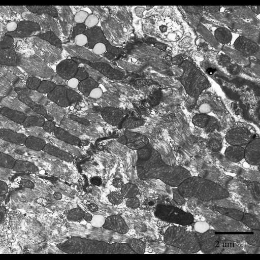  NCBI Organism:Mus musculus; Cell Components:I band, mitochondrion, lipid particle; Biological process:muscle contraction