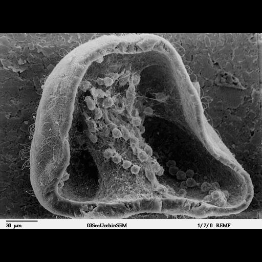  NCBI Organism:Lytechinus pictus; Cell Types:mesenchymal cell Cell Components:cell surface, extracellular space, extracellular matrix; Biological process:cell migration, embryonic morphogenesis;