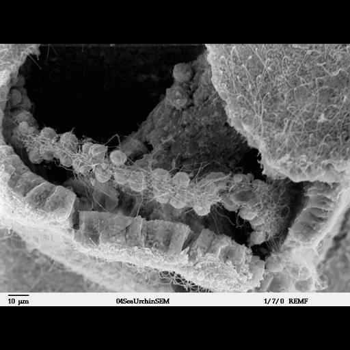  NCBI Organism:Lytechinus pictus; Cell Types:mesenchymal cell Cell Components:cilium, microvillus, cell surface; Biological process:embryonic morphogenesis