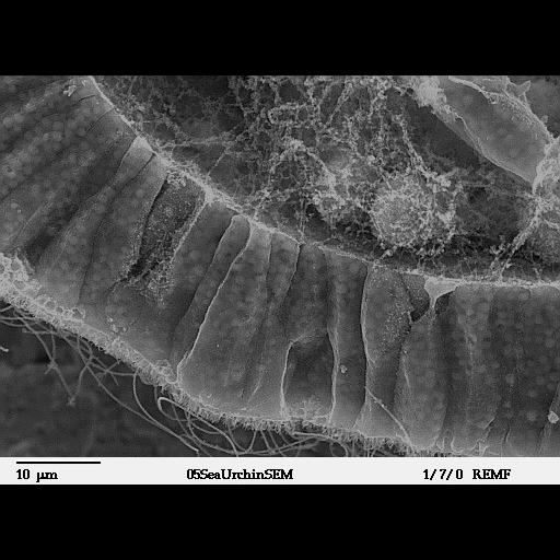  NCBI Organism:Lytechinus pictus; Cell Types:epithelial cell, mesenchymal cell; Cell Components:cilium, microvillus, cell surface, fertilization envelope, extracellular matrix, extracellular region; Biological process:embryonic morphogenesis, cell migration;