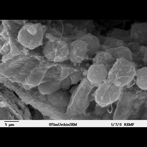  NCBI Organism:Lytechinus pictus; Cell Types:mesenchymal cell, epithelial cell; Cell Components:cell surface Biological process:embryonic morphogenesis, cell migration;