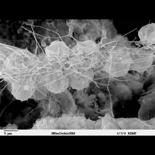  NCBI Organism:Lytechinus pictus; Cell Types:mesenchymal cell Cell Components:cell surface, extracellular space; Biological process:, embryonic morphogenesis;