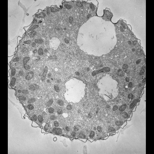  NCBI Organism:Tetrahymena pyriformis; Cell Types:cell by organism, eukaryotic cell, , ; Cell Components:contractile vacuole pore, contractile vacuole, cell cortex; Biological process:contractile vacuole organization