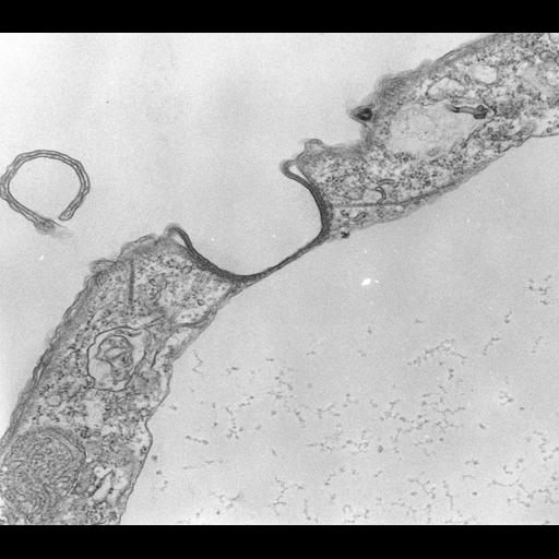  NCBI Organism:Tetrahymena pyriformis; Cell Types:cell by organism, eukaryotic cell, , ; Cell Components:contractile vacuole, contractile vacuole pore, contractile vacuolar membrane, cell cortex, microtubule associated complex; Biological process:contractile vacuole organization