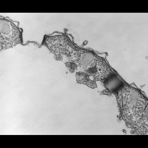  NCBI Organism:Tetrahymena pyriformis; Cell Types:cell by organism, eukaryotic cell, , ; Cell Components:contractile vacuole pore, contractile vacuole, microtubule associated complex, cell cortex; Biological process:contractile vacuole organization