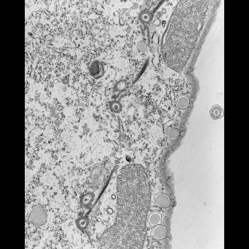  NCBI Organism:Tetrahymena pyriformis; Cell Types:cell by organism, eukaryotic cell, , ; Cell Components:microtubule basal body, microtubule associated complex, fibril; Biological process:microtubule basal body duplication