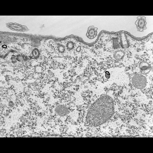  NCBI Organism:Tetrahymena pyriformis; Cell Types:cell by organism, eukaryotic cell, , ; Cell Components:microtubule basal body, microtubule associated complex; Biological process:microtubule basal body duplication