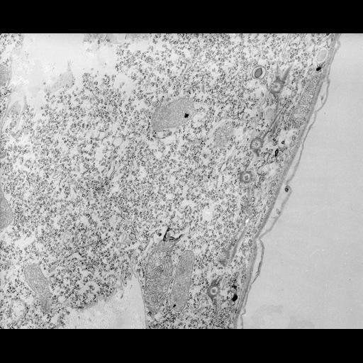  NCBI Organism:Tetrahymena pyriformis; Cell Types:cell by organism, eukaryotic cell, , ; Cell Components:microtubule basal body, microtubule associated complex, fibril; Biological process:microtubule basal body duplication