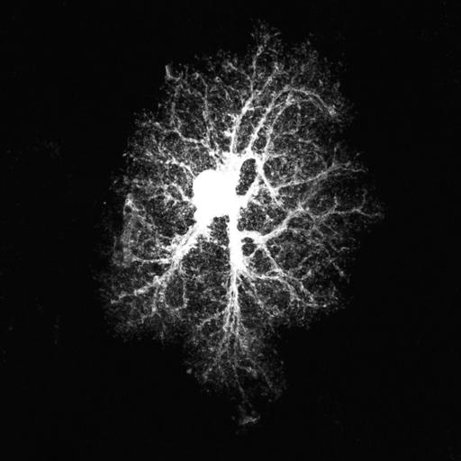  NCBI Organism:Rattus norvegicus; Cell Types:astrocyte, astrocyte of the hippocampus; Cell Components:cell projection cytoplasm, cell body; Biological process:forebrain astrocyte development, cell projection organization;