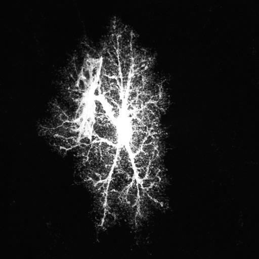  NCBI Organism:Rattus norvegicus; Cell Types:astrocyte, astrocyte of the hippocampus; Cell Components:cell projection cytoplasm, cell body; Biological process:forebrain astrocyte development, cell projection organization;